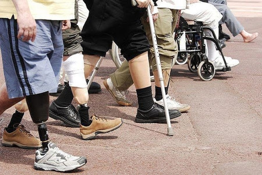 протезування в україні